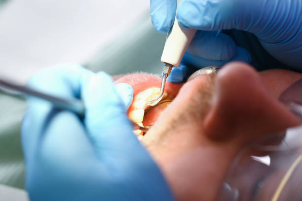 Best Pediatric Emergency Dentist in Benwood, WV